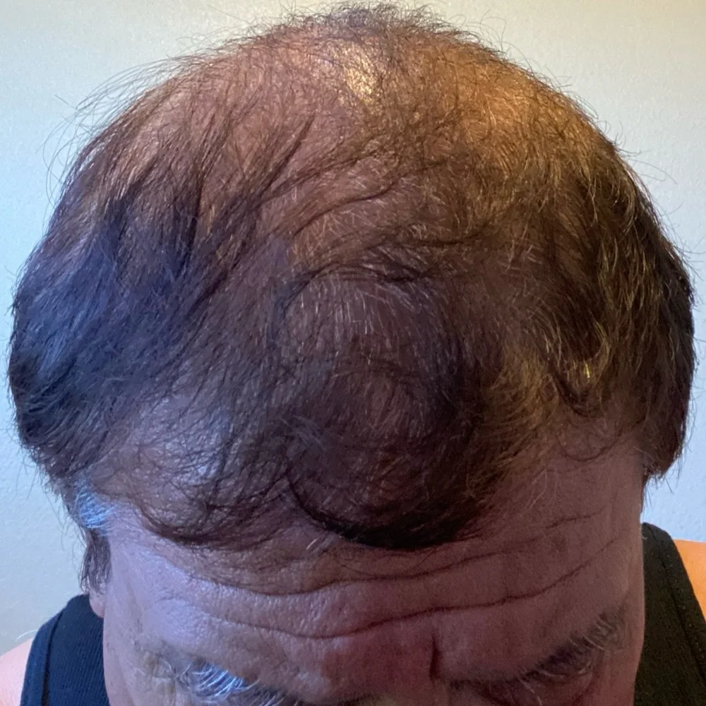 Arzola’s‎ shampoo for hair growth